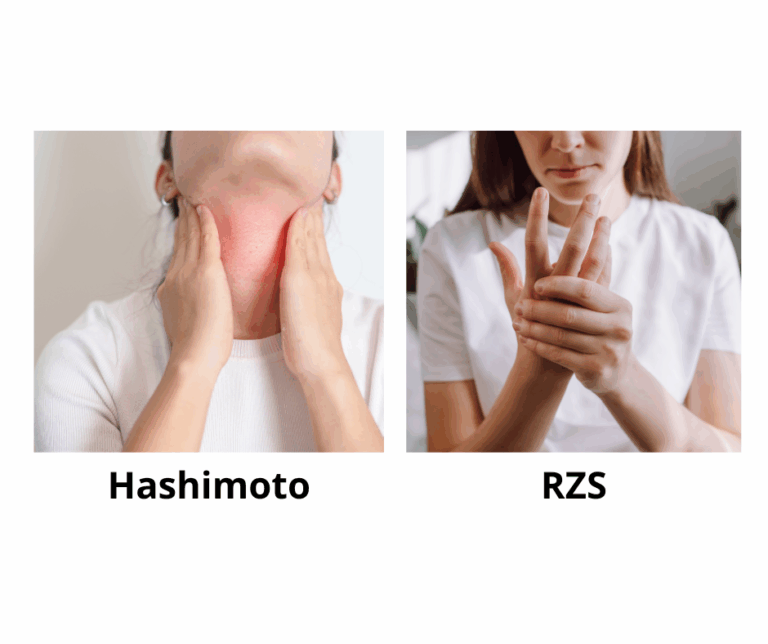 Terapie anti-aging a choroby autoimmunologiczne – co musisz wiedzieć?